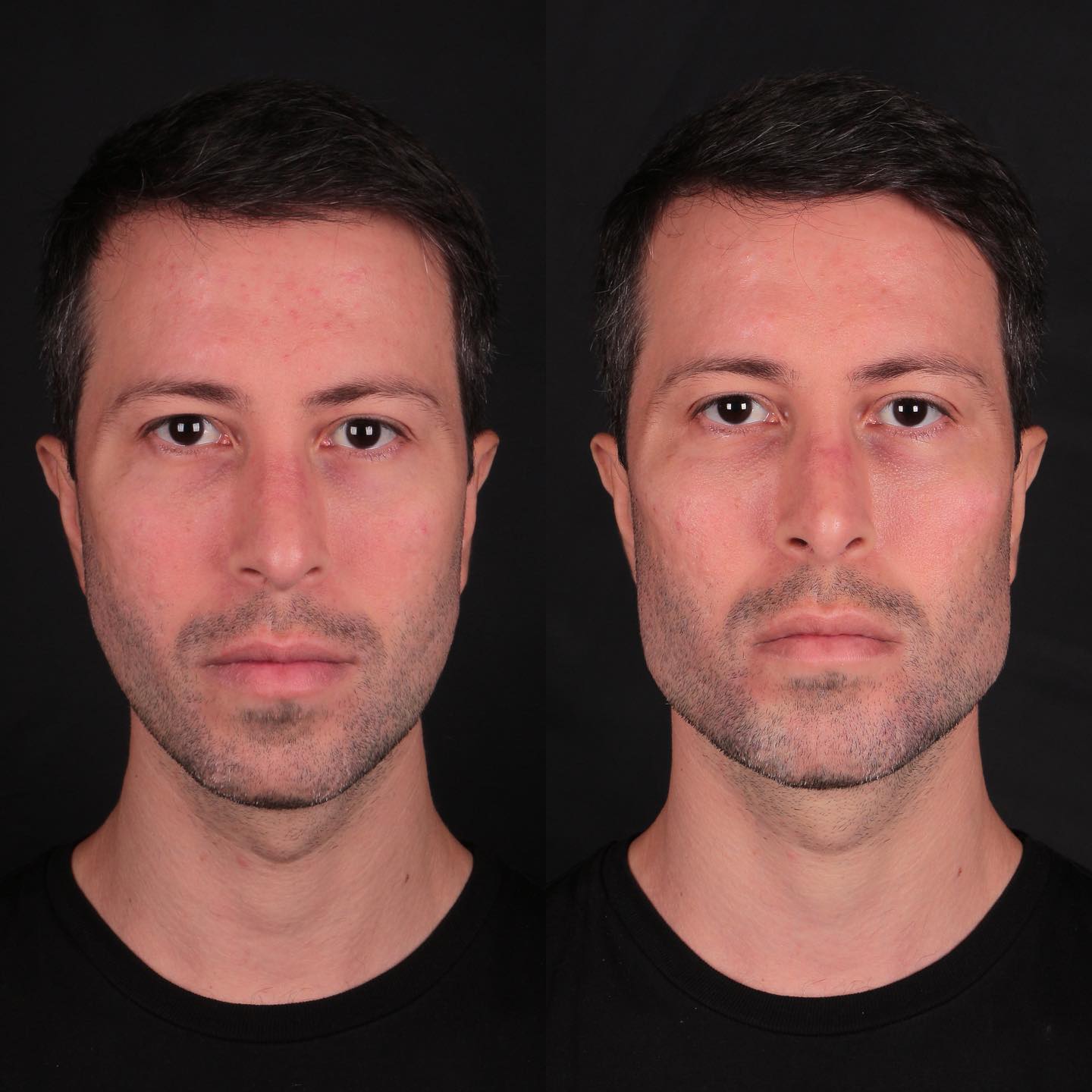 Male facial aesthetics comparison